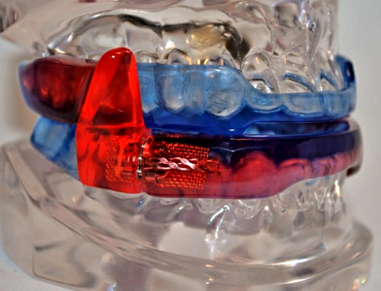 What is sleep apnea? How can my dentist help?