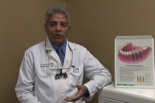 How Long Will Dental Implants Last? (VIDEO)