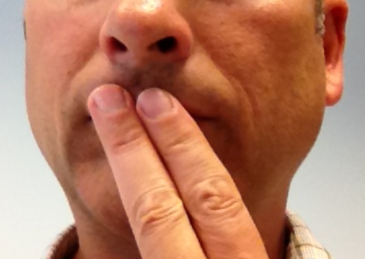 Chronic Dry Mouth: Signs, Symptoms, and Finding Relief