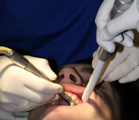 What does it mean if I have swollen or bleeding gums?