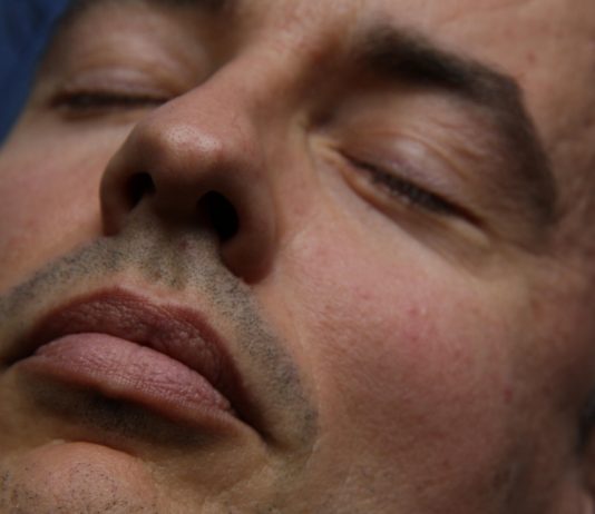 Is Sedation Dentistry Right for You?