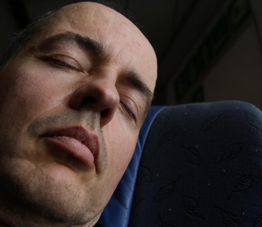 What is a Sleep Apnea Dental Appliance?