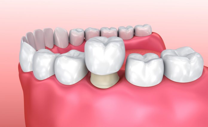 crown-illustration