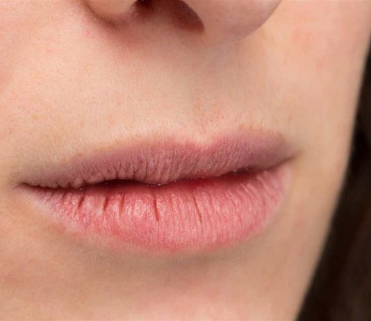 What Could Be Causing Your Dry Mouth?