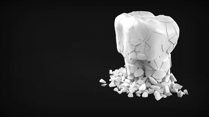 tooth-2887546_1280