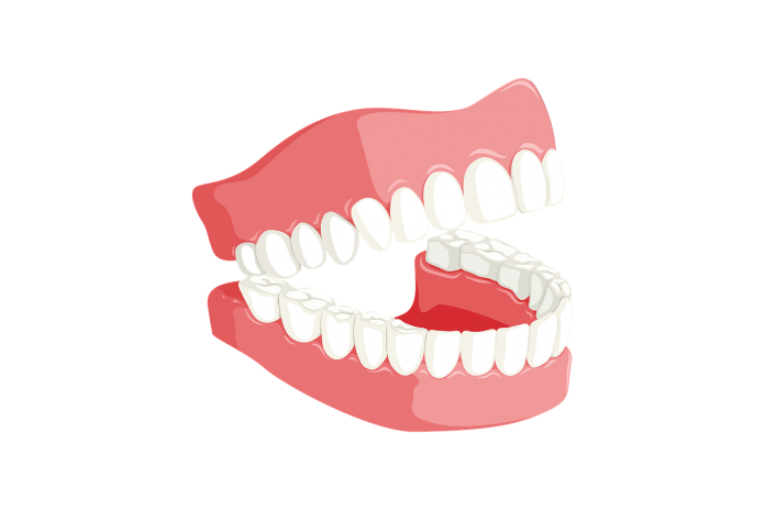 teeth-3414722_1280