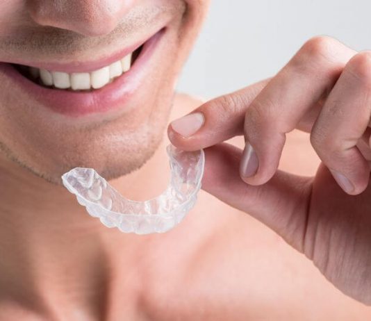 It’s Never Too Late for Adult Braces