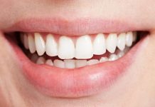 What to Expect When Recovering From Gum Graft Surgery