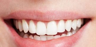 What Is Dental Bonding?