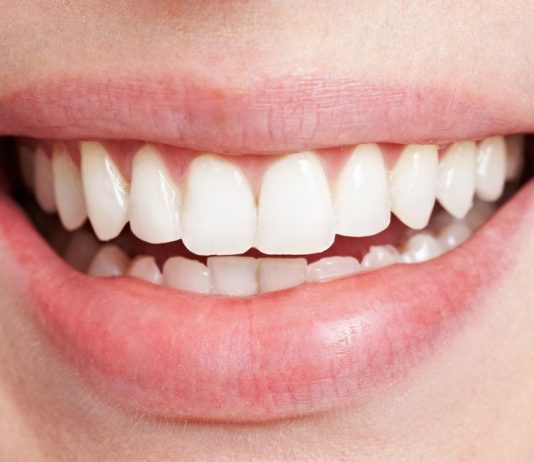 What to Expect When Recovering From Gum Graft Surgery