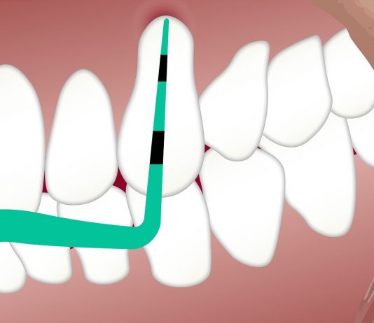 The High Risks of Ignoring Gum Disease