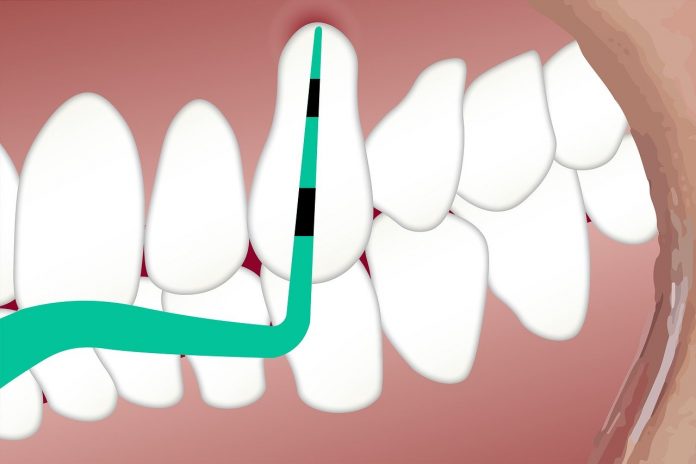 dental-3599725_1280