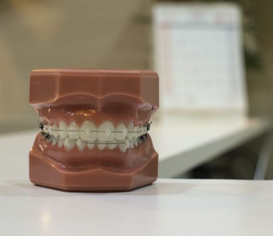 How to Fight Plaque While Wearing Braces