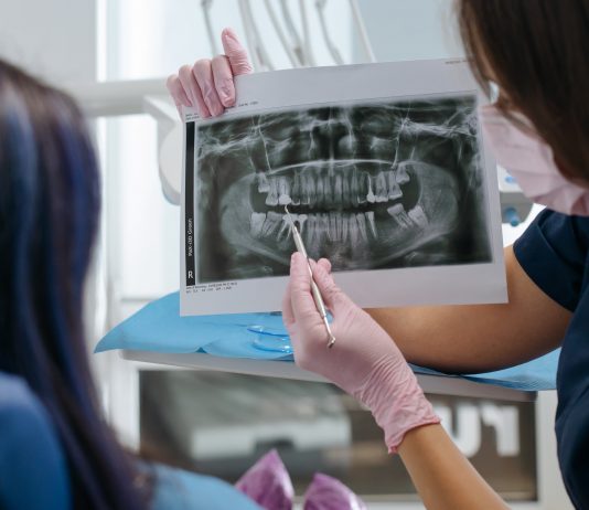 What Your Dentist Is Looking for When They Look at Your X-Rays