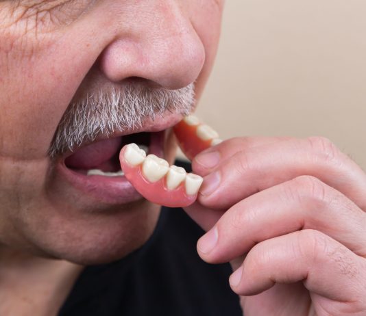 The Most Common Reasons for Tooth Loss in Adults