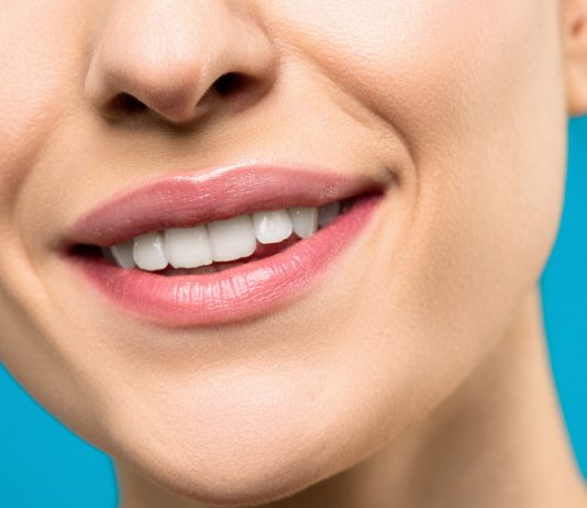 How to Keep Teeth Bright After Whitening
