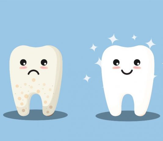 What Are Those White Spots on My Teeth?