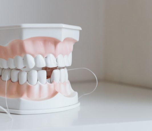 Top Causes of Tooth Loss