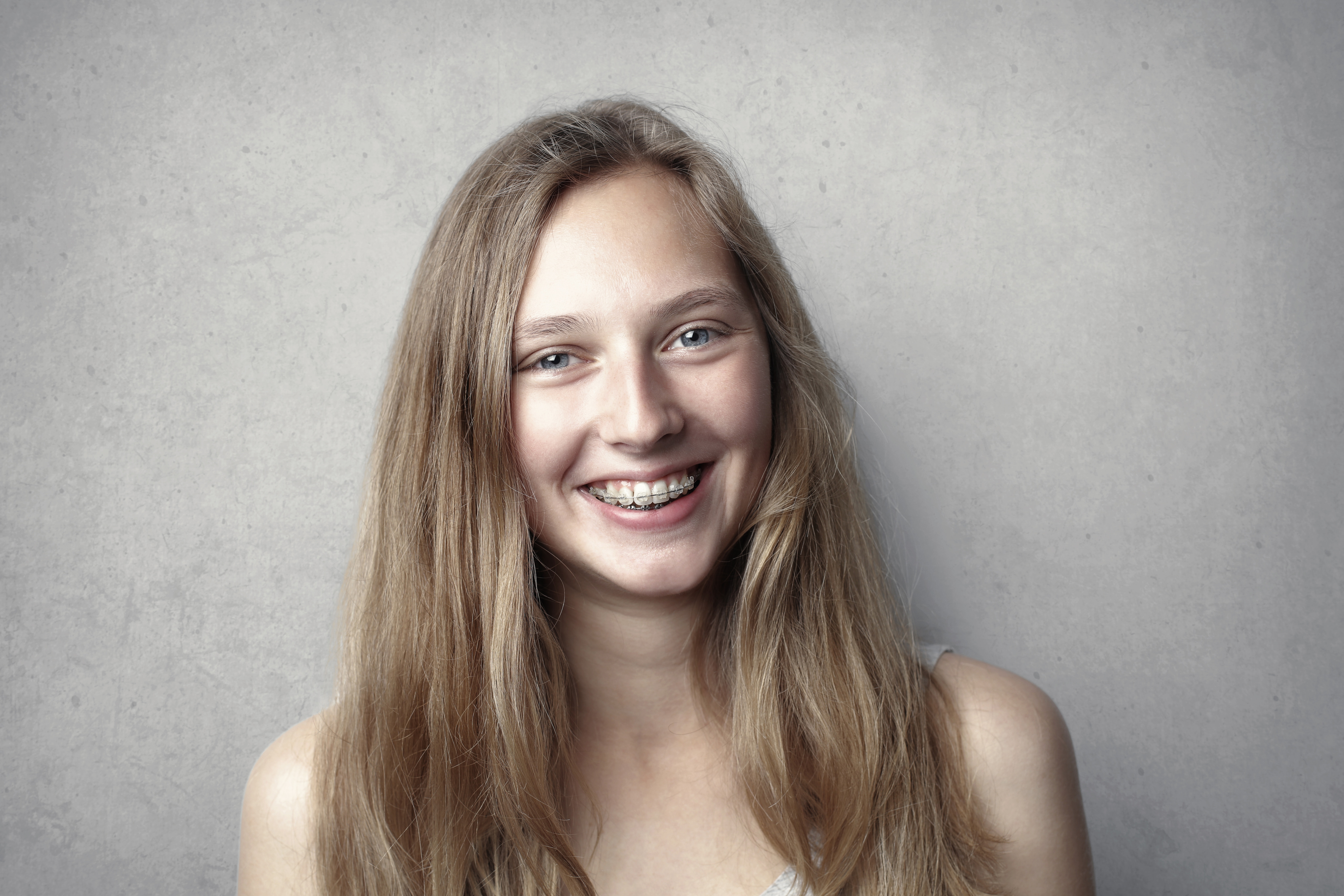 What Should You Avoid When You Have Braces?