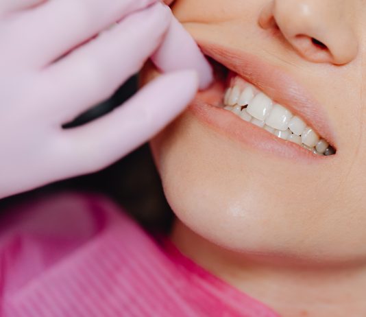 Can Teeth Grinding (Bruxism) Cause TMJ?