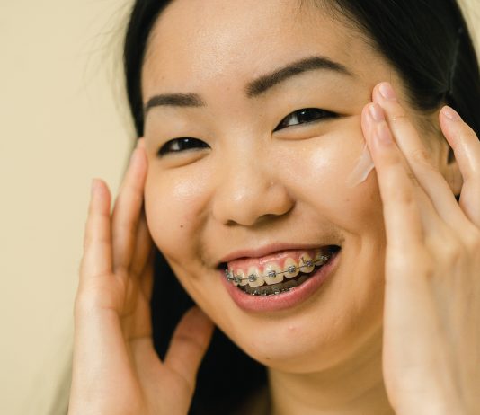 How Do Elastic Bands Help Move Your Teeth?