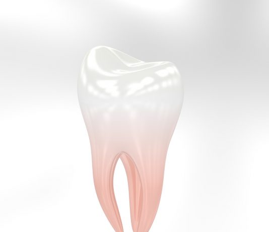 Top Causes of Tooth Loss