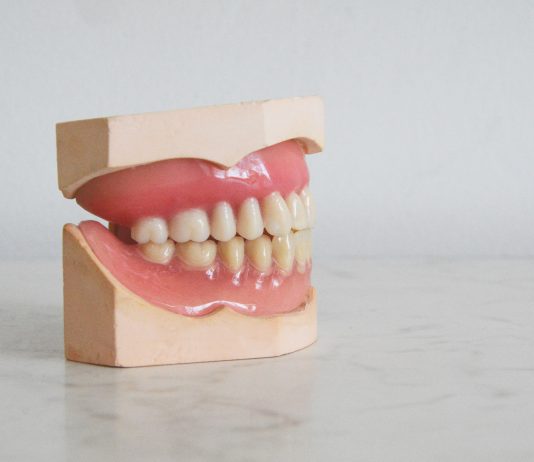 What Are the Potential Health Impacts of Missing Teeth?