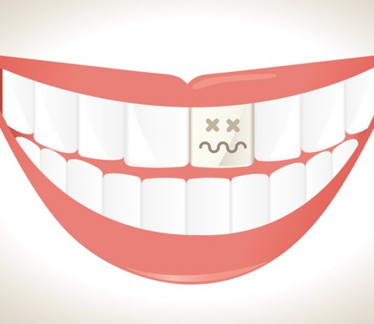 Is Your Tooth Turning Gray? This Could Be the Cause