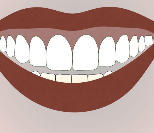 Canted Teeth: What Are They, and How Can You Fix Them?