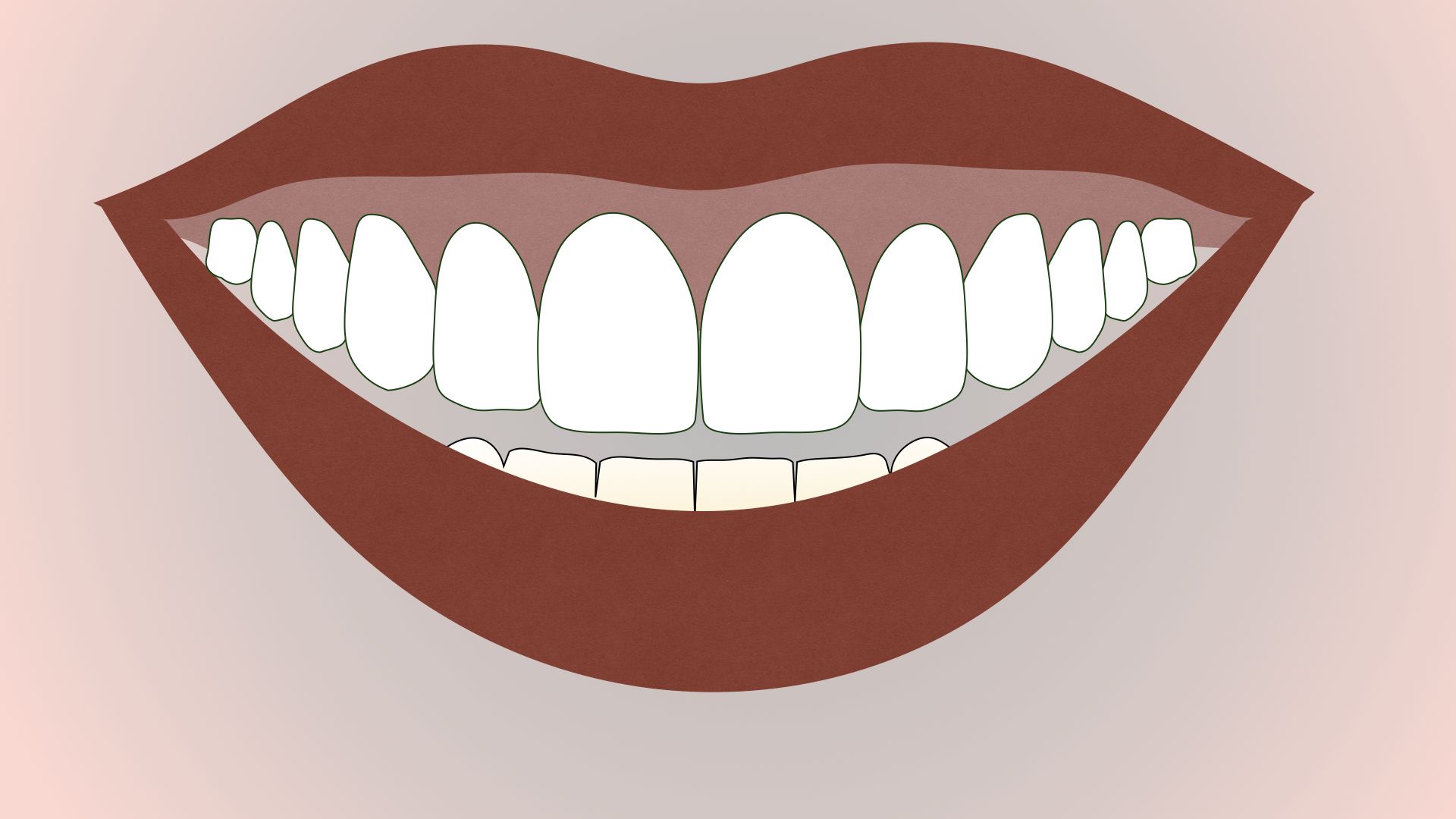Canted Teeth: What Are They, and How Can You Fix Them?