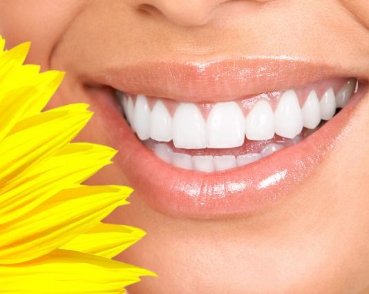 Who Is a Candidate for Dental Bonding?