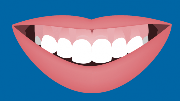 how-to-fix-a-gummy-smile-with-braces