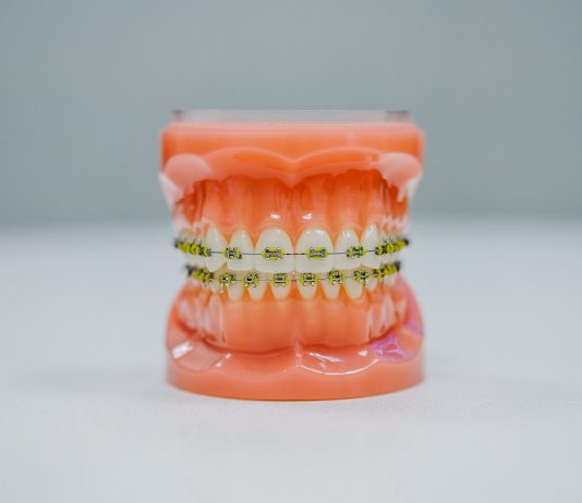 Can Orthodontics Improve Speech Impediments?