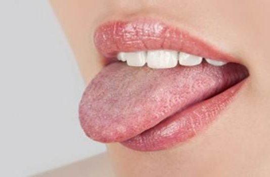 Why Does Oral Thrush Develop, and How Can You Get Rid of It?