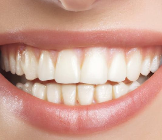 Can Cosmetic Dentistry Fix a Gummy Smile? gummy smile