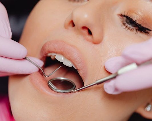 What Is Scaling and Root Planing? root planing and scaling lansdowne dentist
