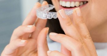 teeth aligner orthodontics
