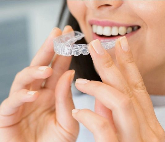 Do I Need to Wear a Retainer After Completing Treatment With Teeth Aligners? teeth aligner orthodontics