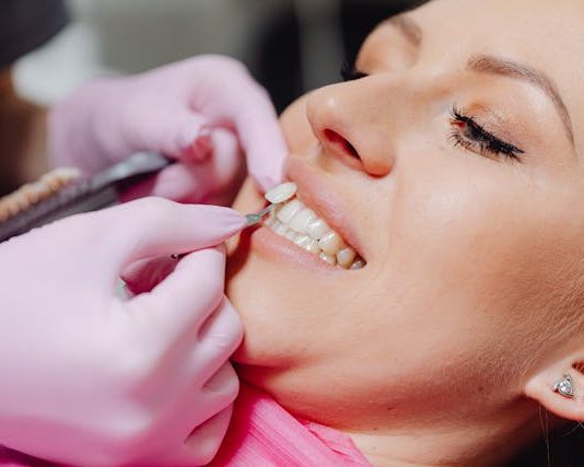 What to Do If a Dental Veneer Comes Off dental veneers