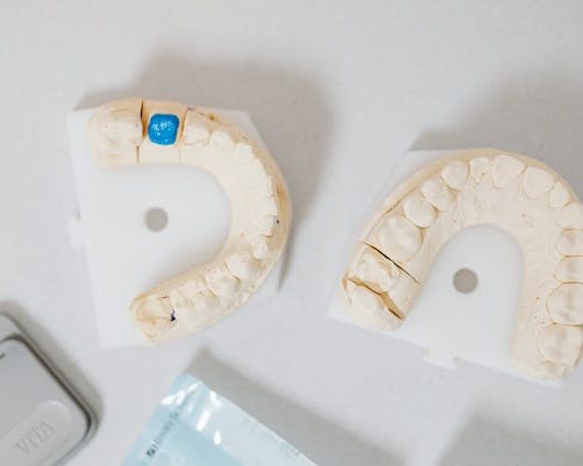 How Long Do Dental Crowns Usually Last?