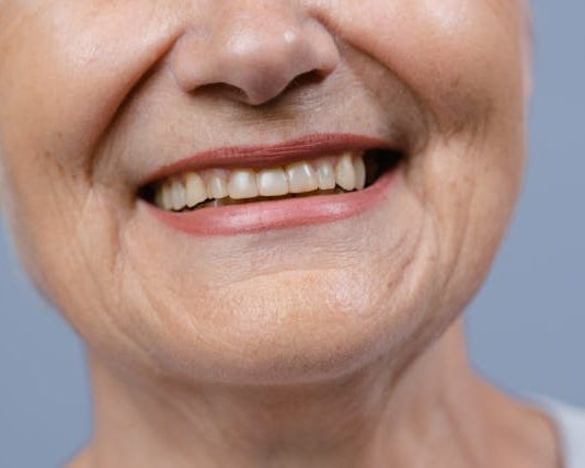 Do Teeth Naturally Become Discolored With Age? teeth discoloration dentist Orangevale CA