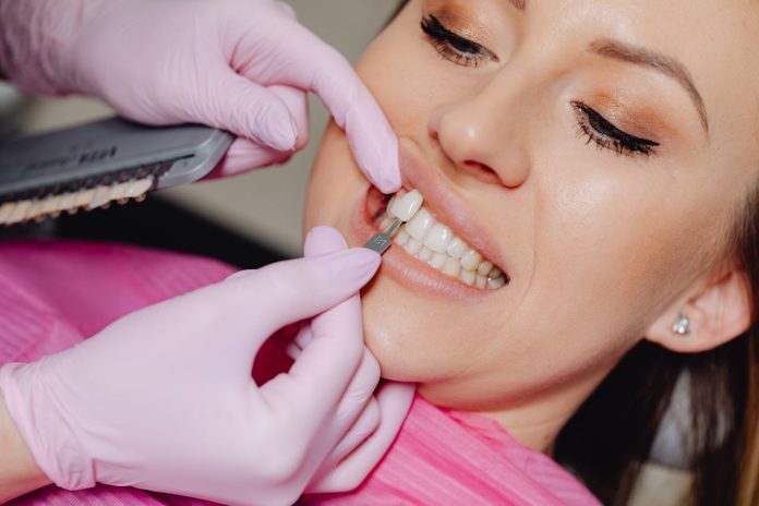 pexels-karolina-grabowska-6627572 dental veneers