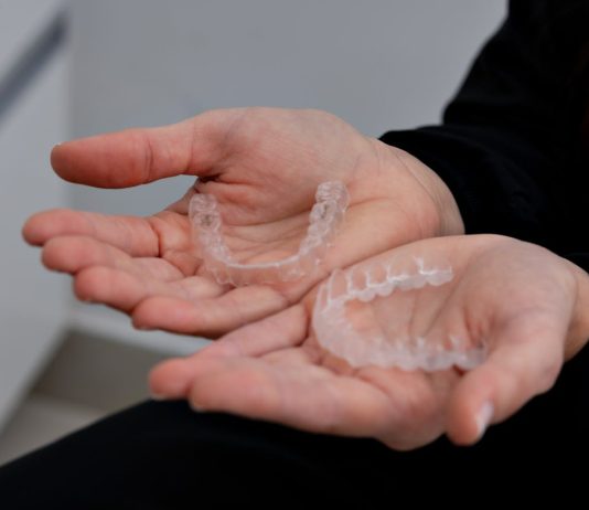 Smart Technology Embedded in New Teeth Aligners Provides New Oral Health Insight clear aligners