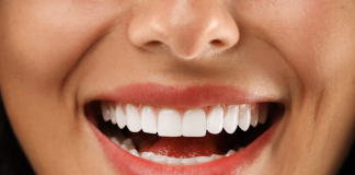 How to Know If I Am a Good Candidate for Dental Veneers Dental Veneers