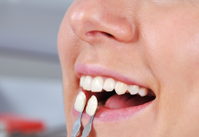 What’s the Difference Between Dental Veneers and Crowns? dental veneers