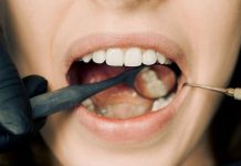 Are Dental Crowns as Strong as Natural Teeth? dental crowns lansdowne va