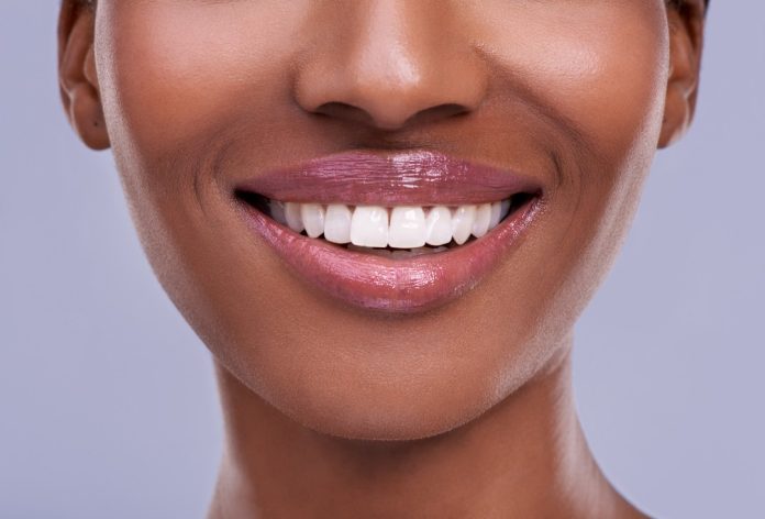 fixing a gummy smile cosmetic dentistry