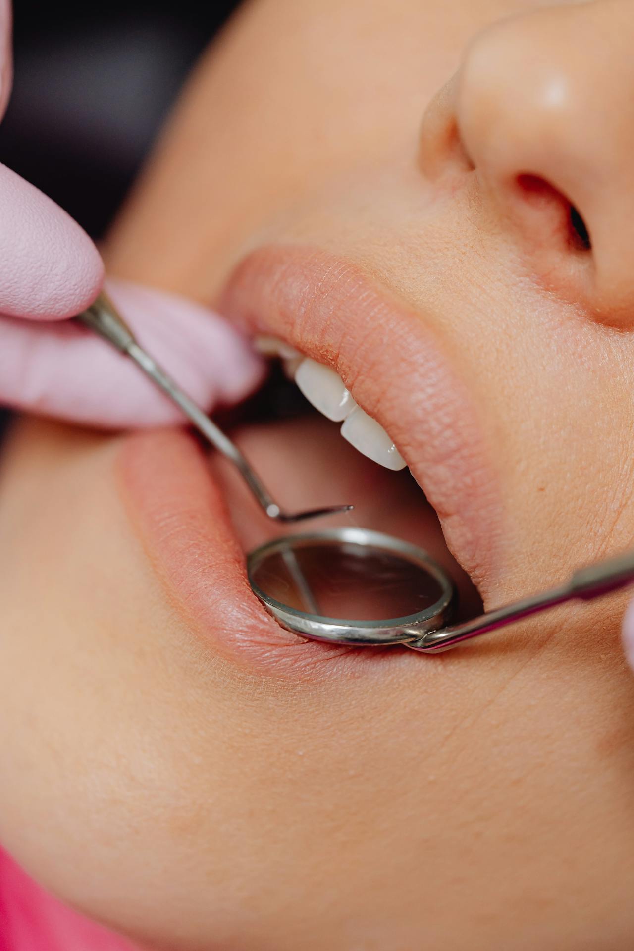 Can a Dentist Help Treat Causes of Chronic Bad Breath?