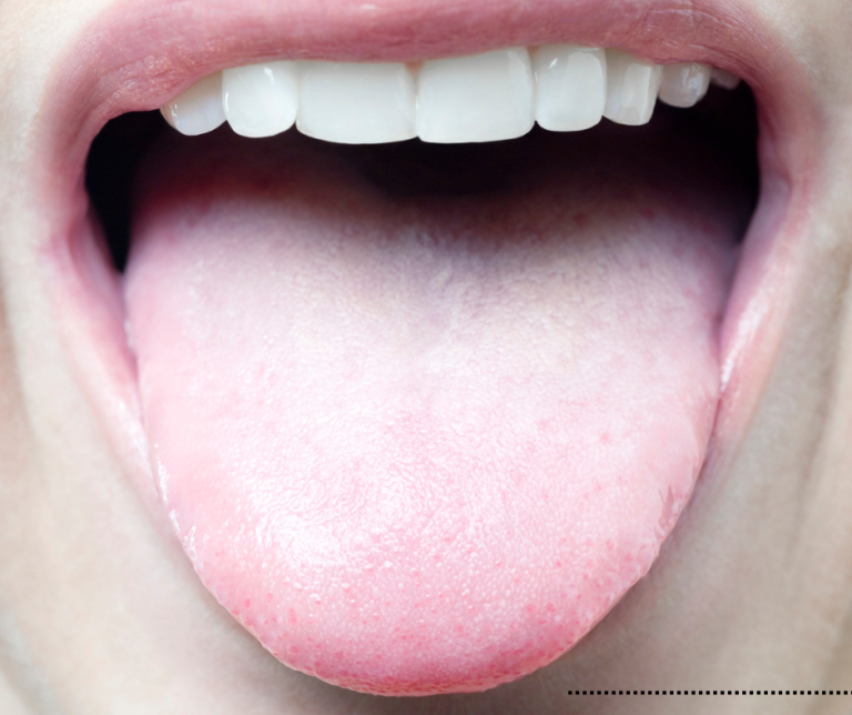 Why Tongue Cleaning Should Be Part of Your Daily Oral Health Routine