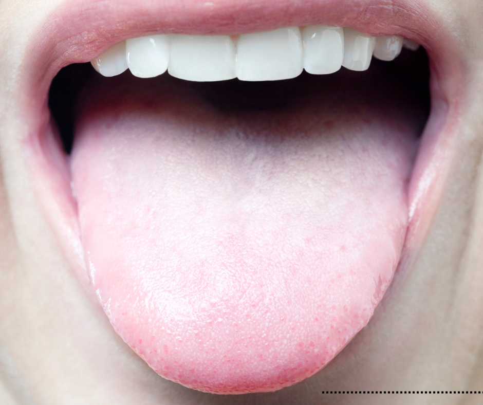 Why Tongue Cleaning Should Be Part of Your Daily Oral Health Routine